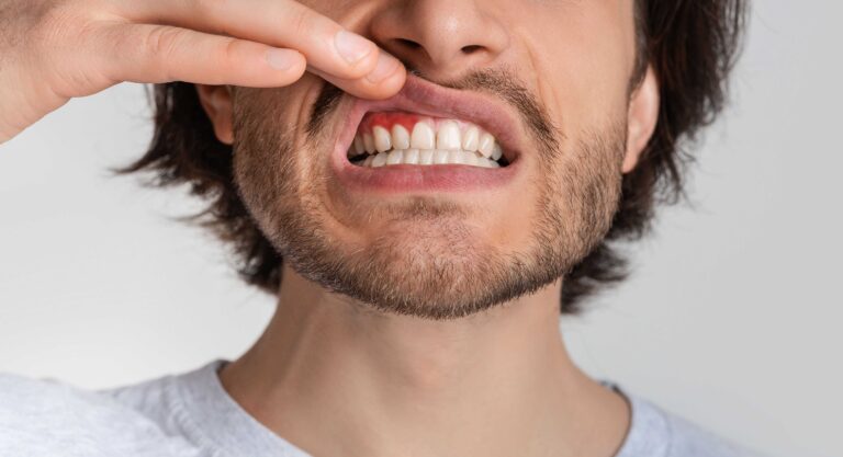 Can Gum Disease Kill You?