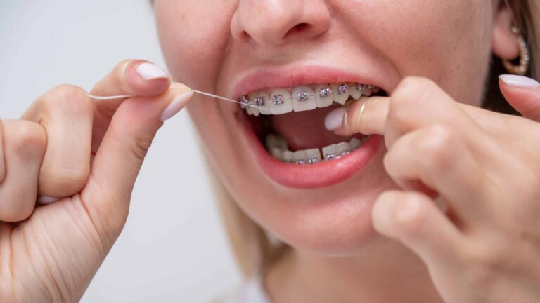 Treating Gum Disease with Braces