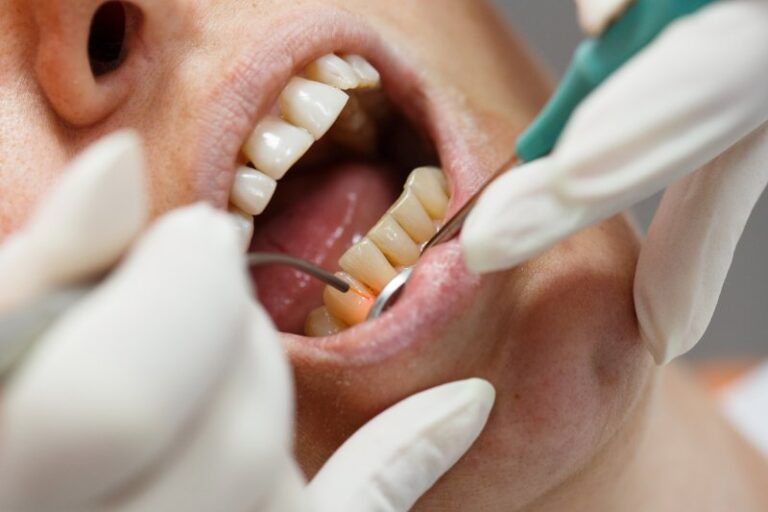 Is Gum Disease Heriditary?